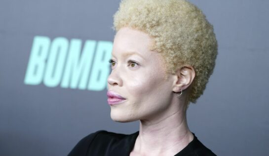 Frumusețea unică a albinismului, surprinsă într-un proiect fotografic