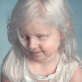 O fetiță care suferă de albinism și care pozează cu o timiditate aparte