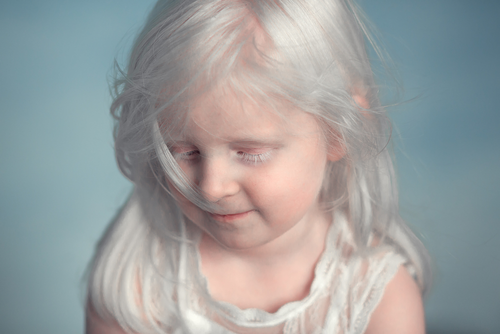 O fetiță care suferă de albinism și care pozează cu o timiditate aparte