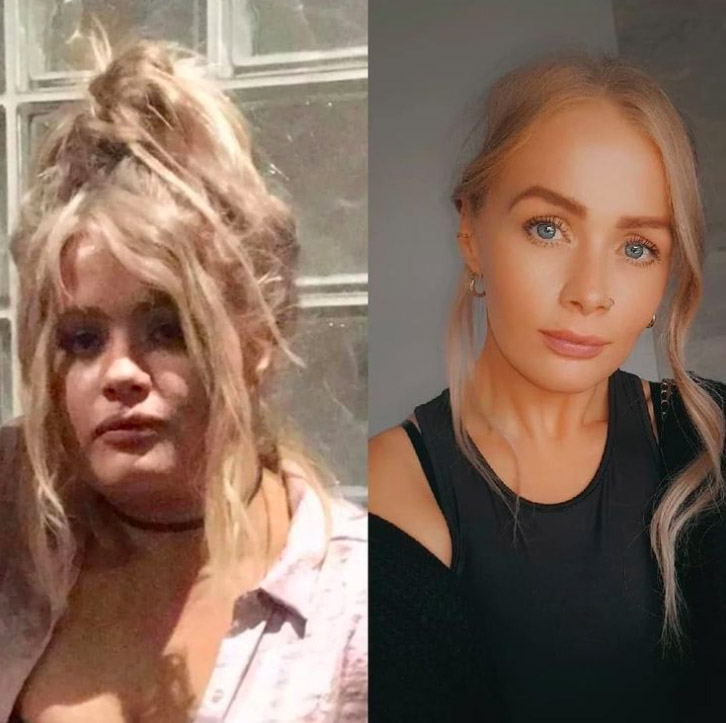 Fața transformată a unei femei, înainte și după slăbire