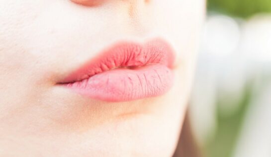 Alimente care îți usucă buzele. Cum poți calma iritațiile