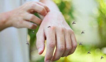 O mână mușcată de țânțari pentru a ilustra faptul că dieta zilnică poate influența apariia acestora în jurul corpului