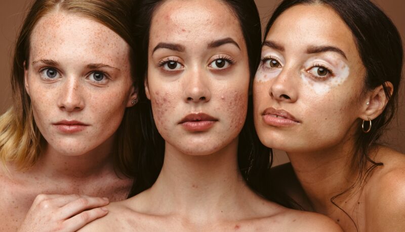 Aspectul pielii este influențat de sănătatea organismului. Lucruri pe care le poate spune despre tine
