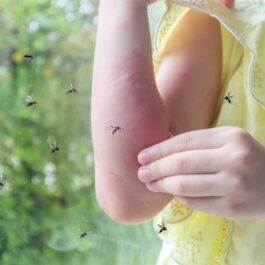 O fetiță care e mușcată și înconjrată de țânțari