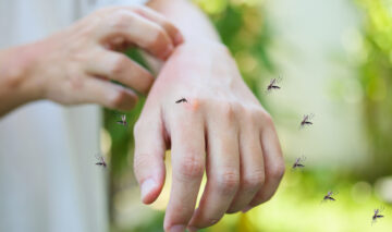 O mână pe care sunt mulți țânțari
