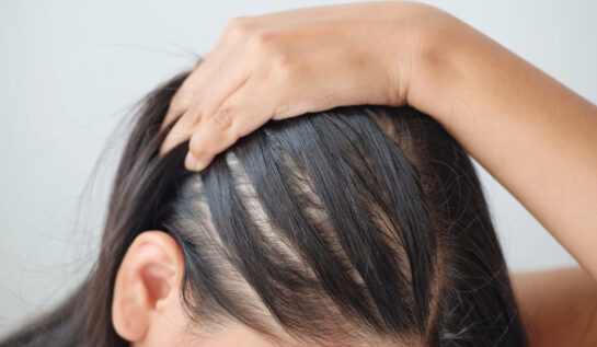 Șampon pentru densitatea părului: cum se alege corect și la ce rezultate să te aștepți