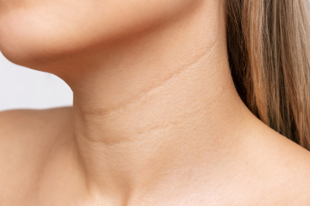 O femeie care are riduri pe gât