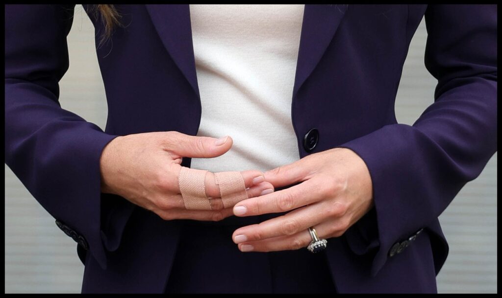 Mâinile lui Kate Middleton, cu două dintre degete bandajate
