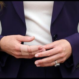 Mâinile lui Kate Middleton, cu două dintre degete bandajate