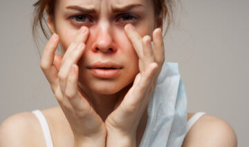 O femeie care se confruntă cu alergie pe față
