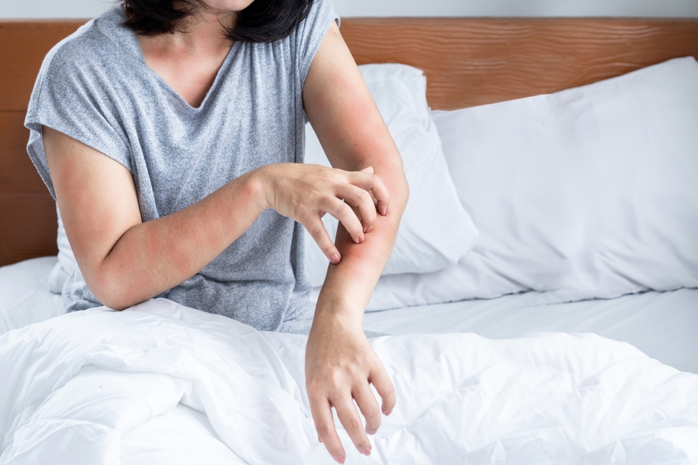 O femeie într-un pat, cu mușcături pe braț
