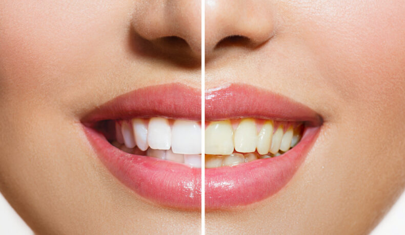 Trucul care poate face o diferență enormă în sănătatea dinților. Dacă îl omiți, e momentul să-ți revizuiești rutina